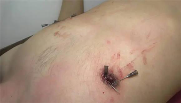 【冷柔】超残忍虐乳