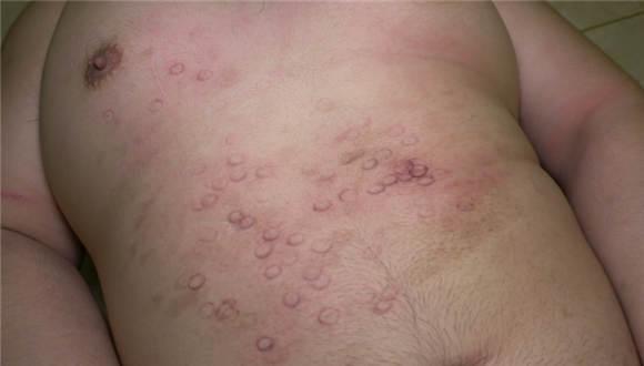 【冷柔】骑瘫贱狗，暴力踩踏