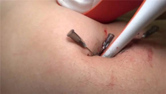 【冷柔】超残忍虐乳