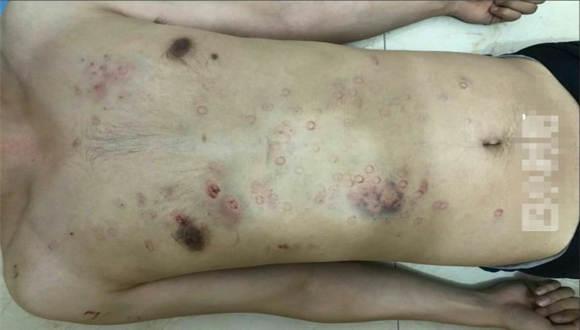 【冷柔】痛苦的地毯