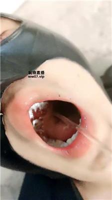 【Qi7】挑战重度sp JS250413-19