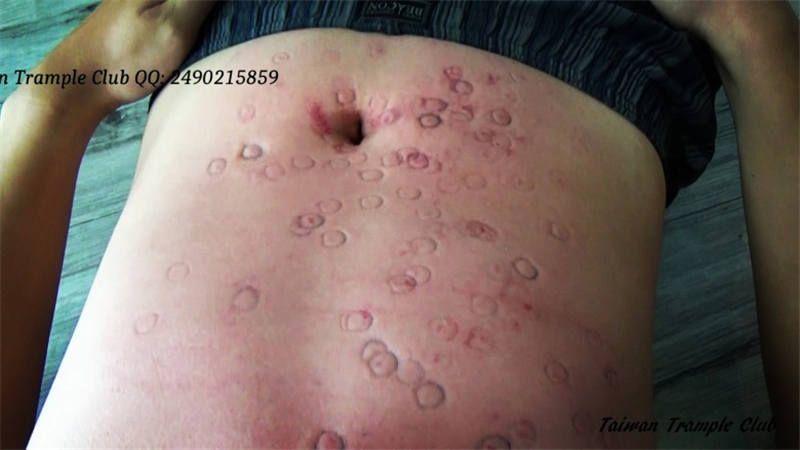 高跟鞋下的残忍与痛苦TTC